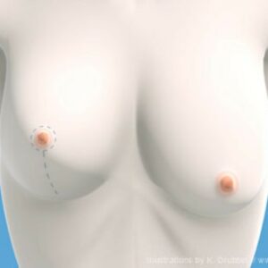 Esthetische chirurgie