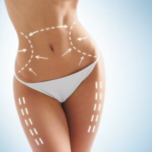 Esthetische chirurgie