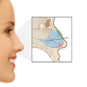 Esthetische chirurgie