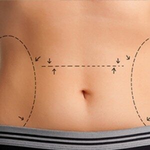 Plastische chirurgie Vlaanderen Plastische chirurgie Vlaanderen
