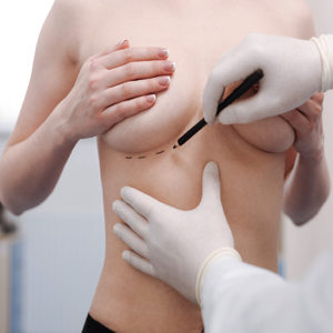 Esthetische chirurgie